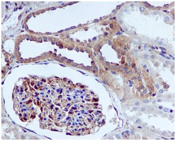 Immunohistochemistry (Formalin/PFA-fixed paraffin-embedded sections) - Anti-IQGAP1 antibody [EPR5220] - Low endotoxin, Azide free (AB222390), expandable thumbnail