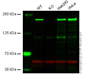 Western blot - Anti-IQGAP1 antibody [EPR5221] (AB109292)