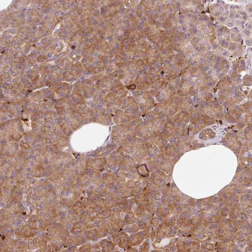 Immunohistochemistry (Formalin/PFA-fixed paraffin-embedded sections) - Anti-IQGAP2 antibody (AB204225)