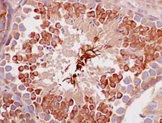 Immunohistochemistry (Formalin/PFA-fixed paraffin-embedded sections) - Anti-IQGAP2 antibody [EPR13382-9] (AB187153)