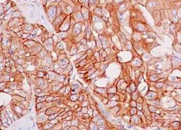 Immunohistochemistry (Formalin/PFA-fixed paraffin-embedded sections) - Anti-IQGAP2 antibody [EPR13382-9] (AB187153)