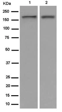 Western blot - Anti-IQGAP2 antibody [EPR13382-9] (AB187153)