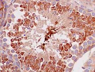 Immunohistochemistry (Formalin/PFA-fixed paraffin-embedded sections) - Anti-IQGAP2 antibody [EPR13382-9] - BSA and Azide free (AB233030), expandable thumbnail