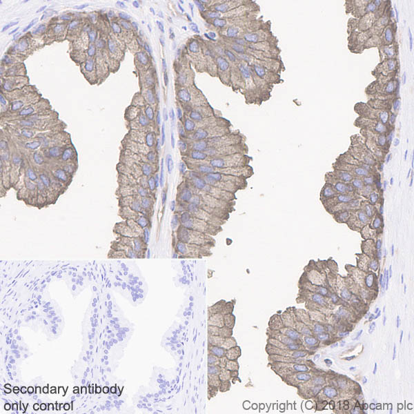 Immunohistochemistry (Formalin/PFA-fixed paraffin-embedded sections) - Anti-IQGAP2 antibody [EPR13382-9] - BSA and Azide free (AB233030), expandable thumbnail