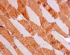Immunohistochemistry (Formalin/PFA-fixed paraffin-embedded sections) - Anti-IQGAP2 antibody [EPR13382] - BSA and Azide free (AB240242)