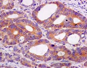 Immunohistochemistry (Formalin/PFA-fixed paraffin-embedded sections) - Anti-IQGAP2 antibody [EPR13382] - BSA and Azide free (AB240242)