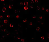 Immunocytochemistry - Anti-IRAK-1 antibody (AB238)