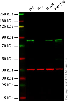 Western blot - Anti-IRAK-1 antibody [EPR19667] (AB208009)