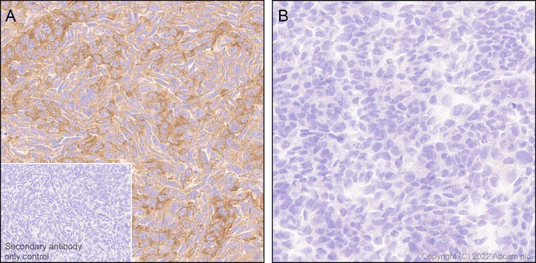 Immunohistochemistry (Formalin/PFA-fixed paraffin-embedded sections) - Anti-IRAK-1 antibody [EPR26375-90] (AB302554)