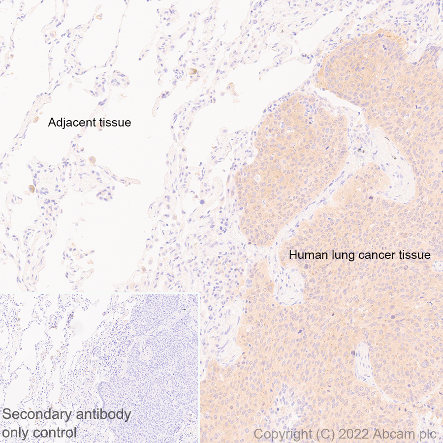 Immunohistochemistry (Formalin/PFA-fixed paraffin-embedded sections) - Anti-IRAK-1 antibody [EPR26375-90] (BSA and Azide free) (AB302555), expandable thumbnail