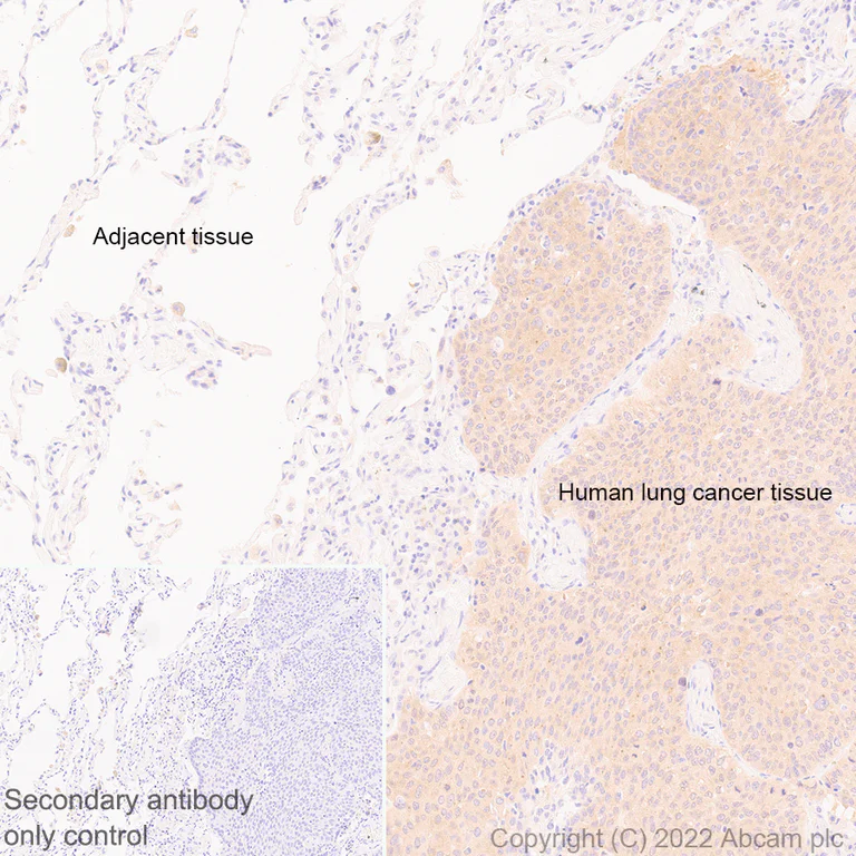 Immunohistochemistry (Formalin/PFA-fixed paraffin-embedded sections) - Anti-IRAK-1 antibody [EPR26375-90] (BSA and Azide free) (AB302555)