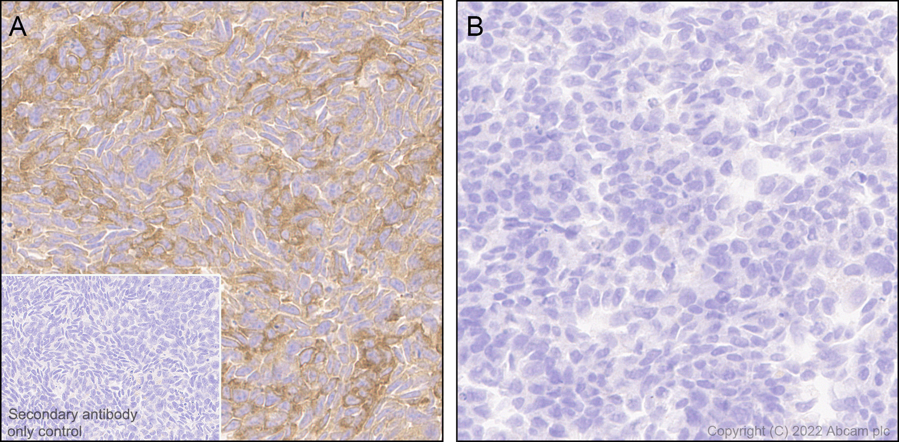 Immunohistochemistry (Formalin/PFA-fixed paraffin-embedded sections) - Anti-IRAK-1 antibody [EPR26375-90] (BSA and Azide free) (AB302555), expandable thumbnail