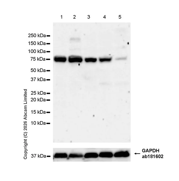 Western blot - Anti-IRAK-1 antibody [EPR29916-78] (AB325680)