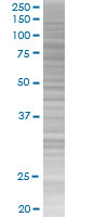 IRAK-1 overexpression 293T lysate (whole cell)