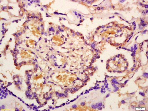 Immunohistochemistry (Formalin/PFA-fixed paraffin-embedded sections) - Anti-IRAK-1 (phospho T209) antibody (AB218130)