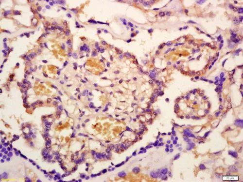 Immunohistochemistry (Formalin/PFA-fixed paraffin-embedded sections) - Anti-IRAK-1 (phospho T209) antibody (AB218130)