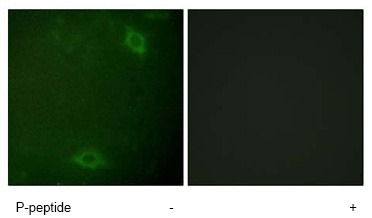 Immunocytochemistry/ Immunofluorescence - Anti-IRAK-1 (phospho T387) antibody (AB112042)