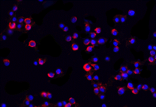 Immunocytochemistry/ Immunofluorescence - Anti-IRAK2 antibody (AB6148), expandable thumbnail