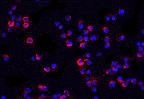 Immunocytochemistry/ Immunofluorescence - Anti-IRAK2 antibody (AB6148)