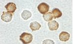 Immunocytochemistry/ Immunofluorescence - Anti-IRAK2 antibody (AB6148), expandable thumbnail
