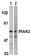 Western blot - Anti-IRAK2 antibody (AB6148)