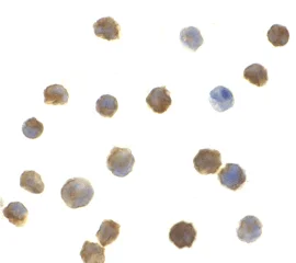 Immunocytochemistry - Anti-IRAK2 antibody (AB62419)