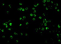 Immunocytochemistry/ Immunofluorescence - Anti-IRAK2 antibody (AB62419)