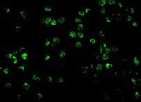 Immunocytochemistry/ Immunofluorescence - Anti-IRAK2 antibody (AB62419)