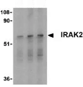 Western blot - Anti-IRAK2 antibody (AB62419)