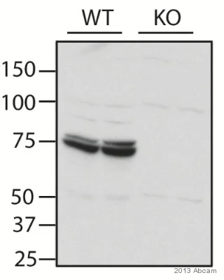 Western blot - Anti-IRAK2 antibody (AB62419)