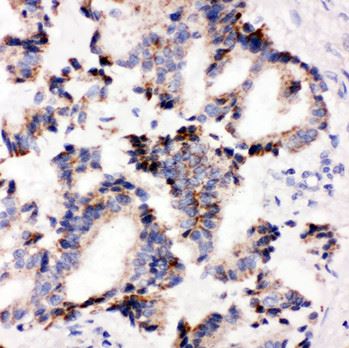 Immunohistochemistry (Formalin/PFA-fixed paraffin-embedded sections) - Anti-IRAK2 antibody - C-terminal (AB191027), expandable thumbnail