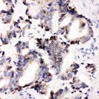 Immunohistochemistry (Formalin/PFA-fixed paraffin-embedded sections) - Anti-IRAK2 antibody - C-terminal (AB191027)