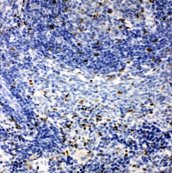 Immunohistochemistry (Formalin/PFA-fixed paraffin-embedded sections) - Anti-IRAK2 antibody - C-terminal (AB191027), expandable thumbnail