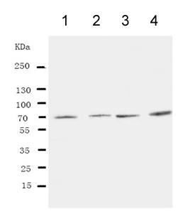 Western blot - Anti-IRAK2 antibody - C-terminal (AB191027), expandable thumbnail