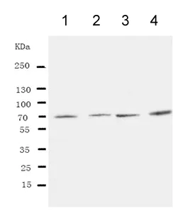 Western blot - Anti-IRAK2 antibody - C-terminal (AB191027)