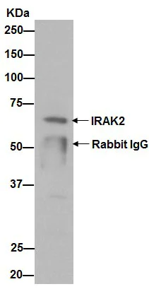 Immunoprecipitation - Anti-IRAK2 antibody [EPR16530] (AB192249)