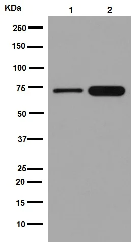 Western blot - Anti-IRAK2 antibody [EPR16530] (AB192249)
