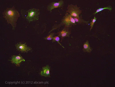 Immunocytochemistry/ Immunofluorescence - Anti-IRAK4 antibody [2H9] (AB119942)