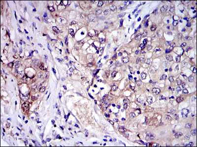 Immunohistochemistry (Formalin/PFA-fixed paraffin-embedded sections) - Anti-IRAK4 antibody [2H9] (AB119942)