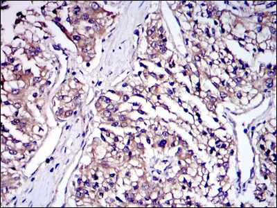 Immunohistochemistry (Formalin/PFA-fixed paraffin-embedded sections) - Anti-IRAK4 antibody [2H9] (AB119942)