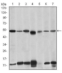 Western blot - Anti-IRAK4 antibody [2H9] (AB119942)