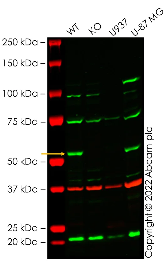 Western blot - Anti-IRAK4 antibody [2H9] (AB119942)