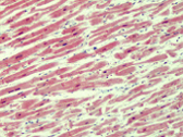 Immunohistochemistry (Formalin/PFA-fixed paraffin-embedded sections) - Anti-IRAK4 antibody (AB113525)