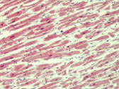 Immunohistochemistry (Formalin/PFA-fixed paraffin-embedded sections) - Anti-IRAK4 antibody (AB113525)