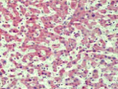 Immunohistochemistry (Formalin/PFA-fixed paraffin-embedded sections) - Anti-IRAK4 antibody (AB113525)