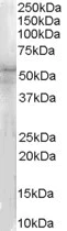 Western blot - Anti-IRAK4 antibody (AB113525)