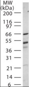 Western blot - Anti-IRAK4 antibody (AB188599), expandable thumbnail