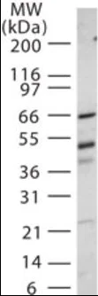 Western blot - Anti-IRAK4 antibody (AB188599)