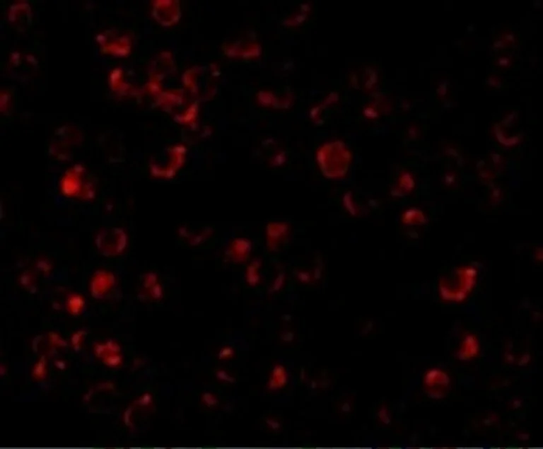 Immunocytochemistry/ Immunofluorescence - Anti-IRAK4 antibody (AB5985)