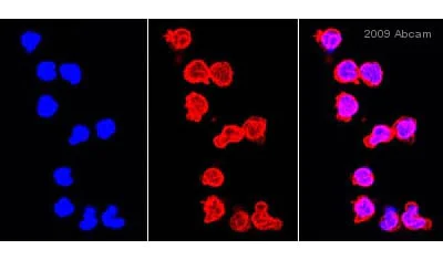 Immunocytochemistry/ Immunofluorescence - Anti-IRAK4 antibody (AB5985)